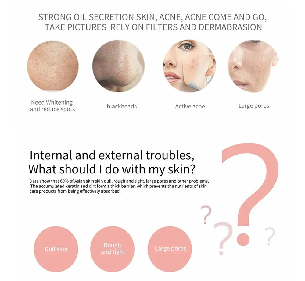 Skin Scrubber Remove Vibrate Deep Face Cleaning Dirt Blackhead Reduce Wrinkles Facial Lifting Peeling Tool Not Ultrasonic Shovel