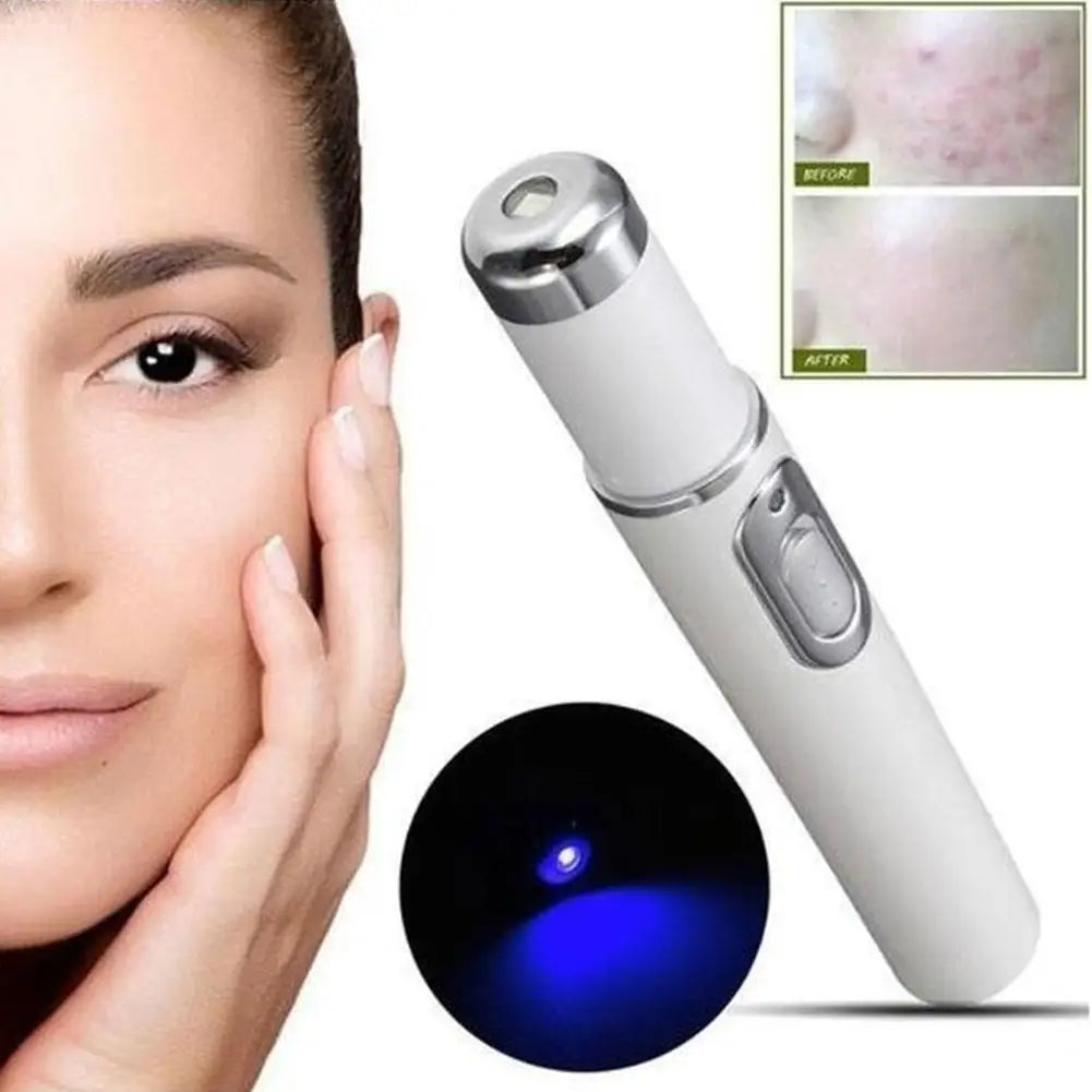 Blue Light Therapy Acne Laser Pen LED Face Light Therapy For Scar Wrinkle Removal Treatment Device Skin Care Beauty Equipment