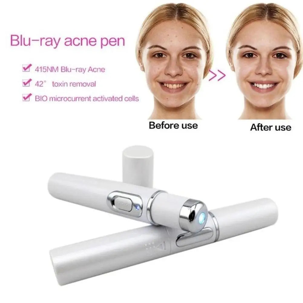 Blue Light Therapy Acne Laser Pen LED Face Light Therapy For Scar Wrinkle Removal Treatment Device Skin Care Beauty Equipment
