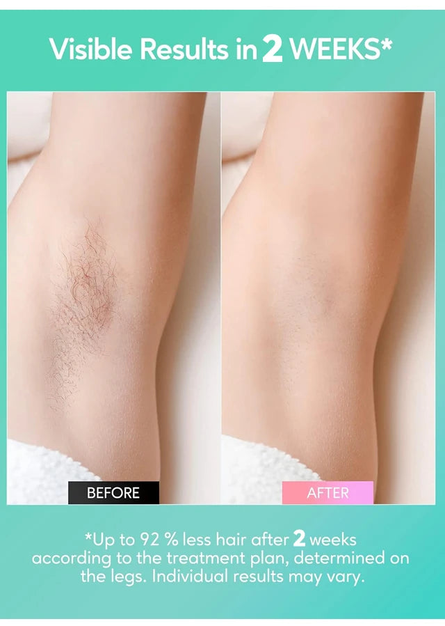 999999 Flash IPL Laser Hair Removal Convenient Home Device for Women Easy Hair Removal Painless Electric Hair Removal