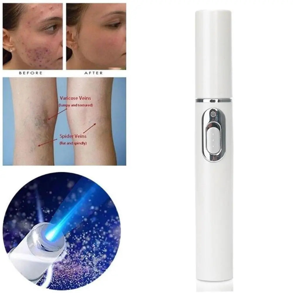 Blue Light Therapy Acne Laser Pen LED Face Light Therapy For Scar Wrinkle Removal Treatment Device Skin Care Beauty Equipment