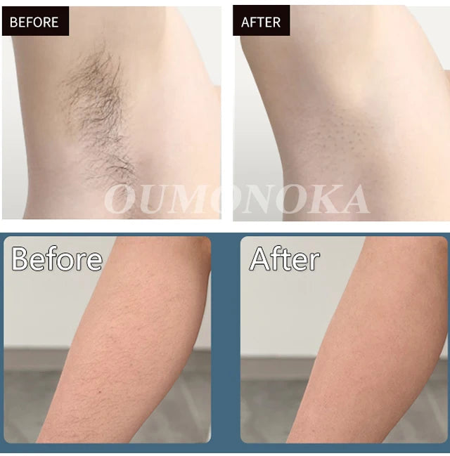 999999 Flash IPL Laser Hair Removal Convenient Home Device for Women Easy Hair Removal Painless Electric Hair Removal