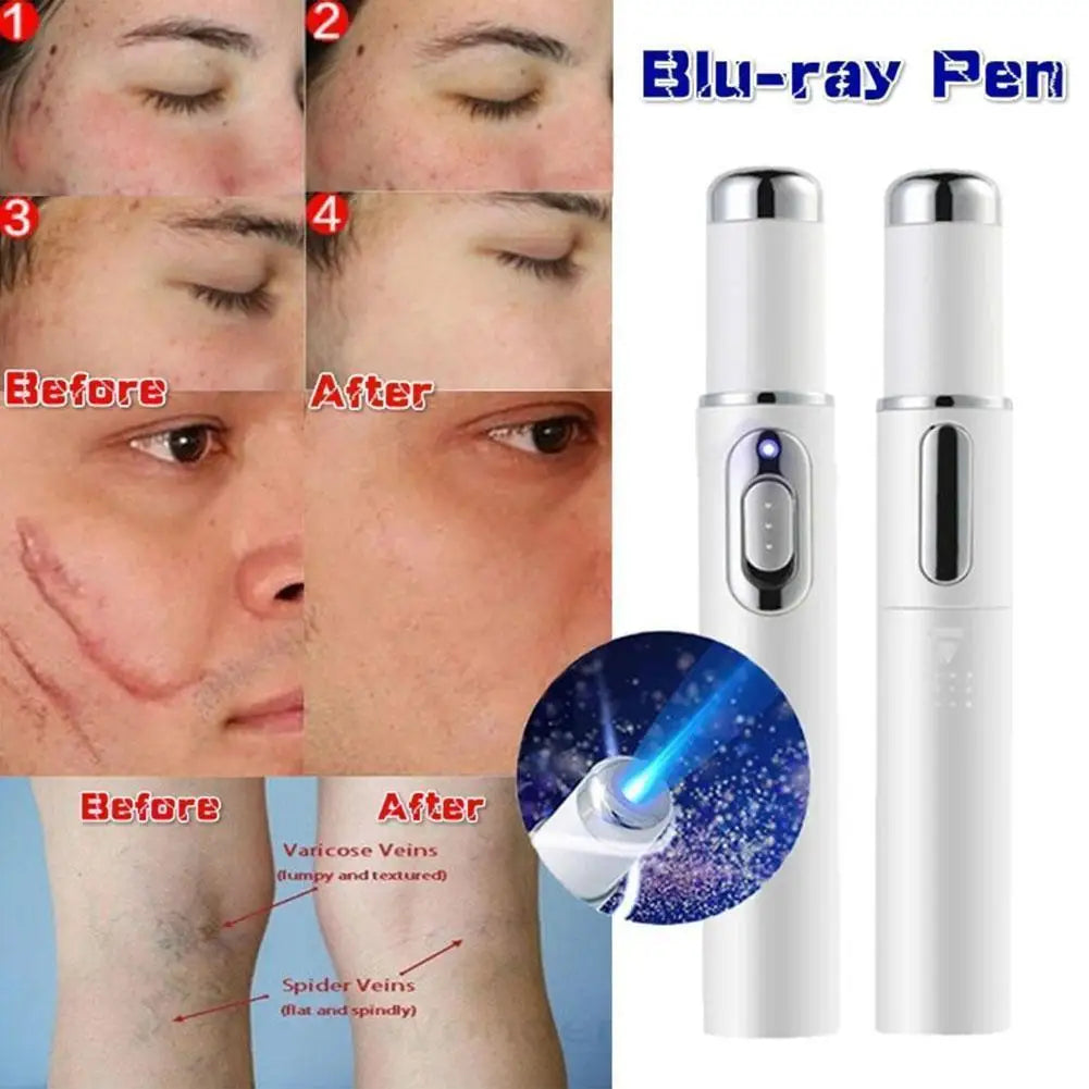 Blue Light Therapy Acne Laser Pen LED Face Light Therapy For Scar Wrinkle Removal Treatment Device Skin Care Beauty Equipment