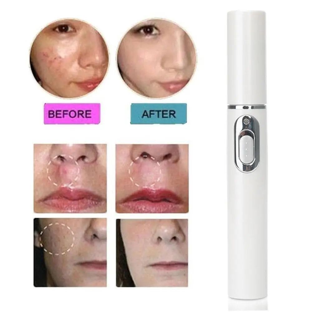Blue Light Therapy Acne Laser Pen LED Face Light Therapy For Scar Wrinkle Removal Treatment Device Skin Care Beauty Equipment