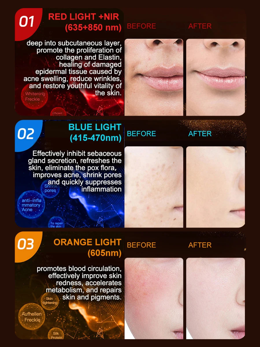 NIR LED Face Mask Red Light Therapy Respirable 3 Colors 807 Lamp Anti-Aging Acne Treat Reduce Wrinkle Full Facial Neck Care Mask