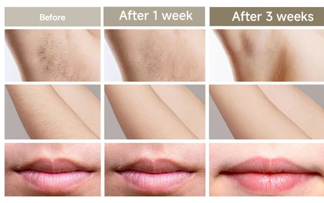 999999 Flash IPL Laser Hair Removal Convenient Home Device for Women Easy Hair Removal Painless Electric Hair Removal