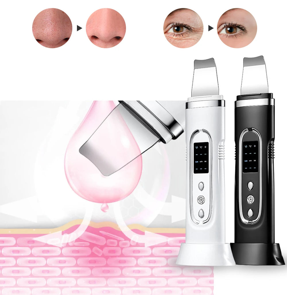 Ultrasonic Skin Scrubber Electric Facial Cleansing Pore Deep Cleanser Acne Blackhead Remover Peeling Shovel Device BeautyMachine