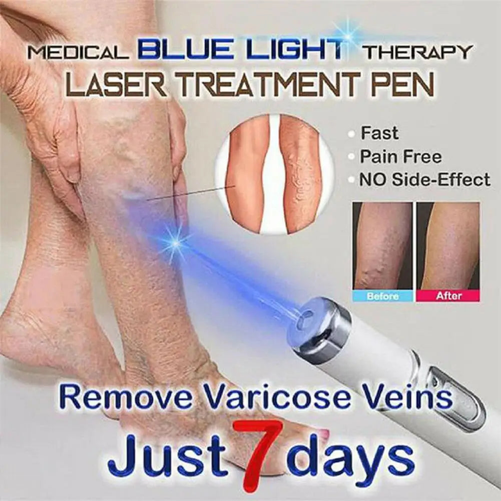 Blue Light Therapy Acne Laser Pen LED Face Light Therapy For Scar Wrinkle Removal Treatment Device Skin Care Beauty Equipment