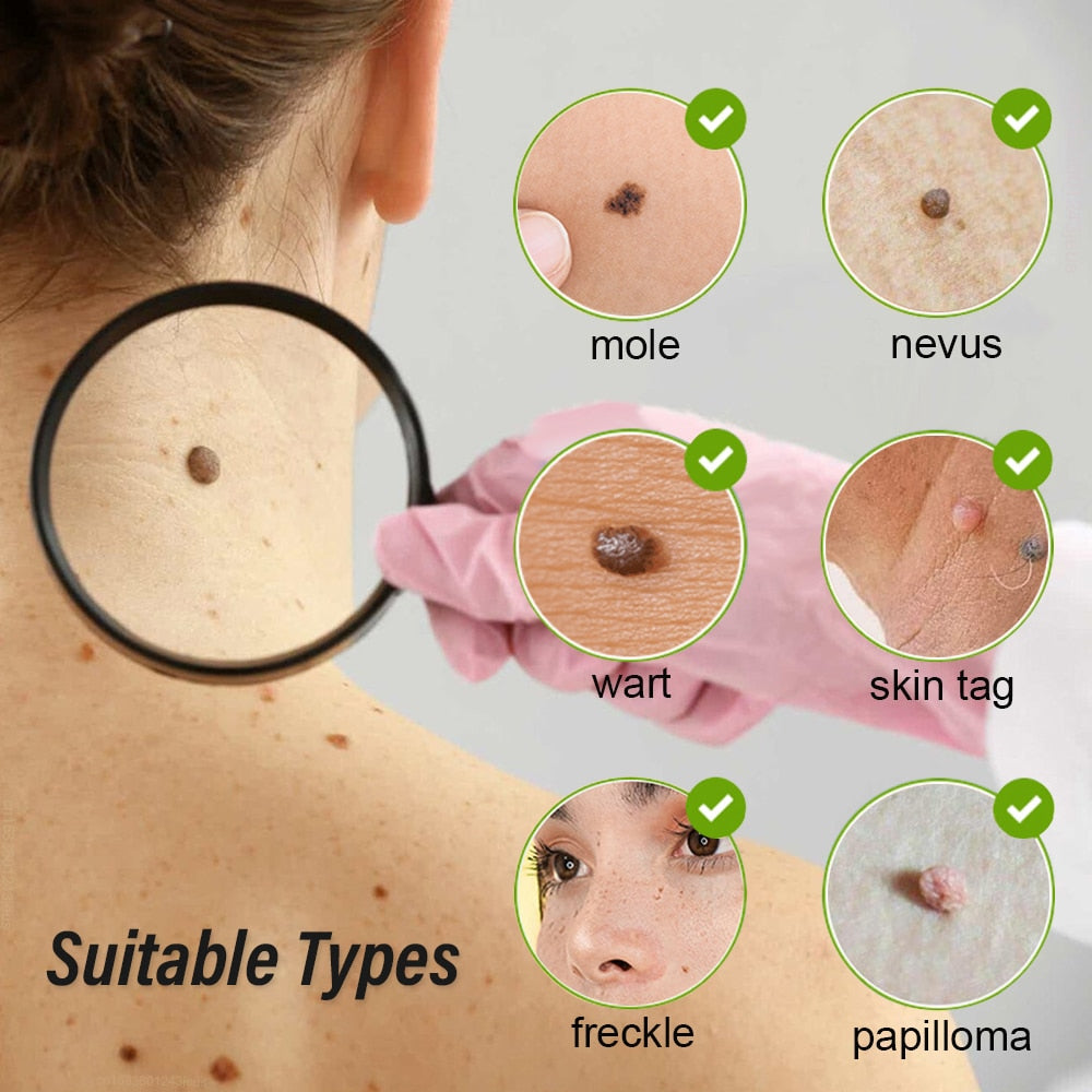 Skin Tag Remover Laser Plasma Pen Dark Spot Mole Wart Remover Pen Electric Tattoo Freckle Nevus Black Spots Skin Tag Removal